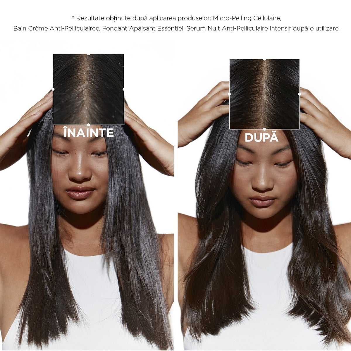 Kérastase Symbiose Bain Crème – Șampon Profesional Anti-Mătreață Fără Sulfați, pentru Scalp Uscat și Sensibil